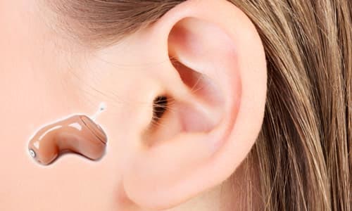 Audífonos RIC o RIE